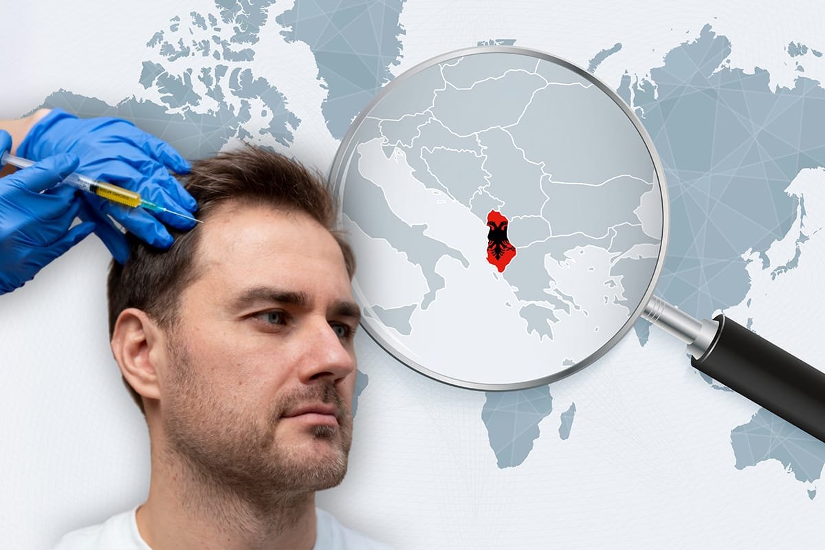 hair transplantation process ongoing